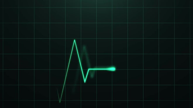 Heartbeat Pulse On Screen Loop - Stock Motion Graphics | Motion Array