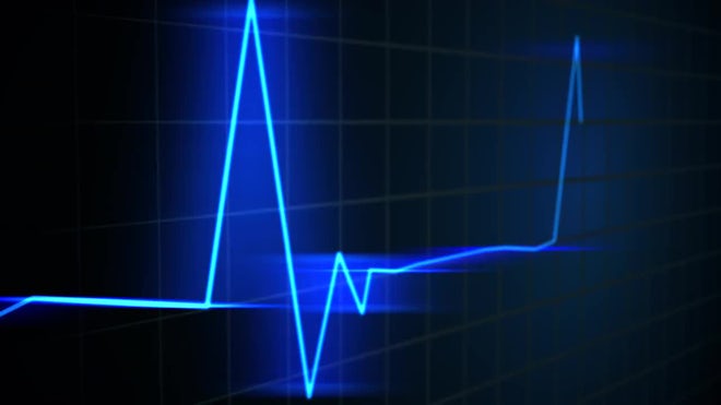 Medical Vital Signs Monitor Screen - Stock Motion Graphics