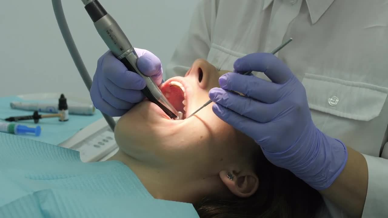 Close Up Of Dentist's Hands... Stock Video Motion Array