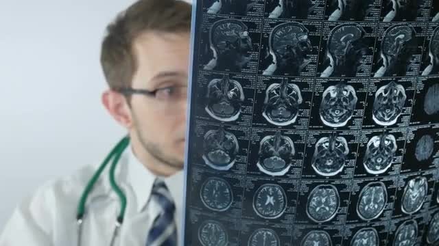 Doctor Analyzing An X-ray Image: Stock Video