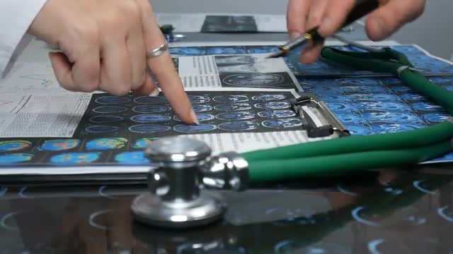 Doctors Discussing MRI Images: Stock Video