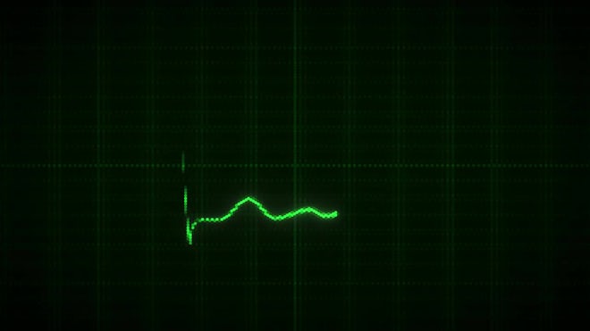 heart rate flatline gif