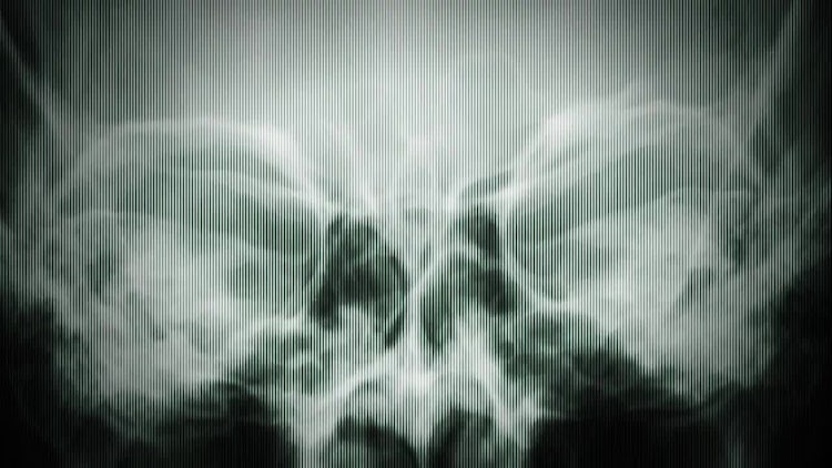 X Rays Texture: Stock Motion Graphics