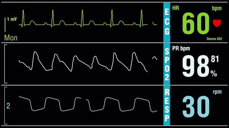 Patient Monitor With Vital Signs: Stock Motion Graphics
