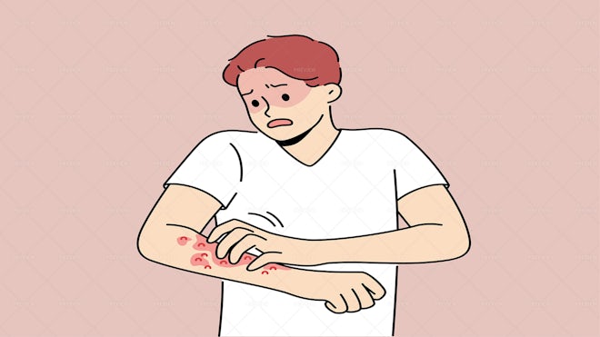 Unhealthy Man Scratch Redness On Arms - Graphics | Motion Array