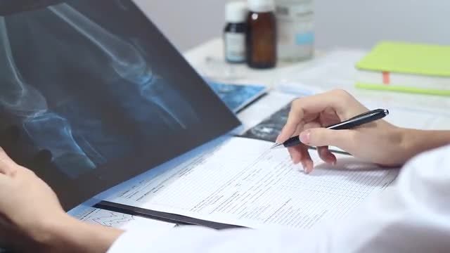 Doctor Studies X-Ray: Stock Video