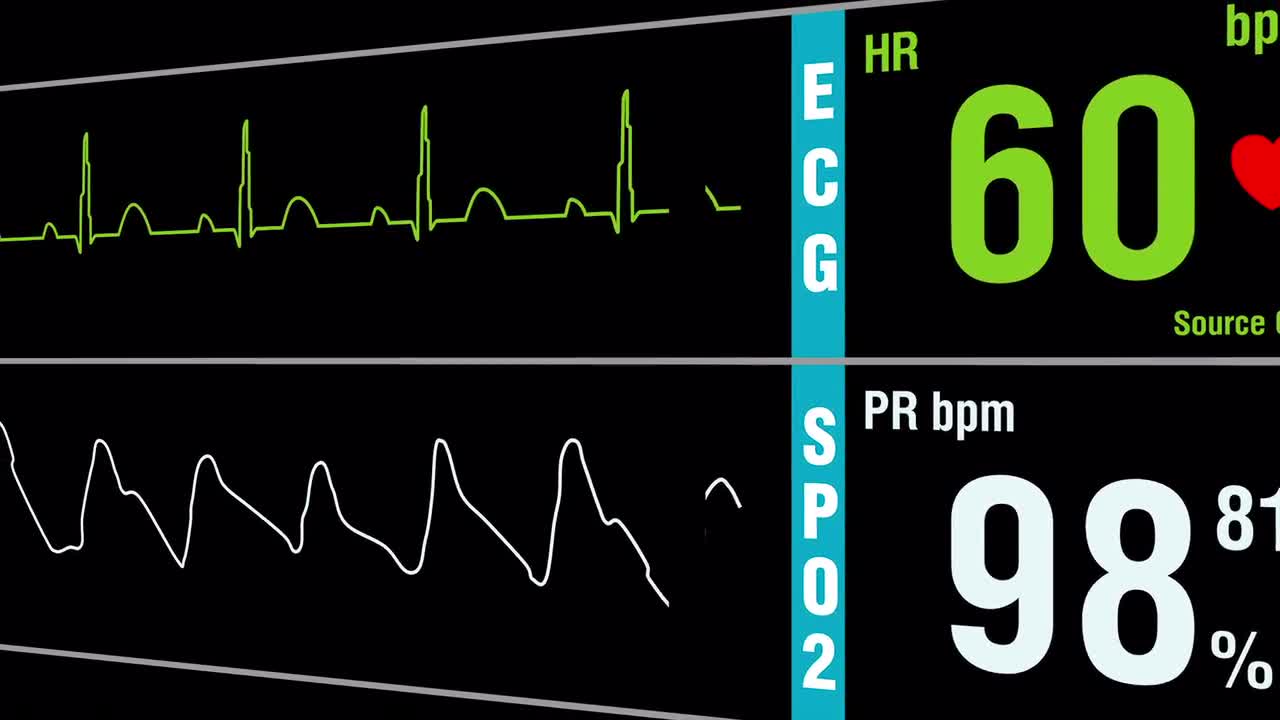 Patient Monitor Displays Medical Vital Signs Stock Motion Graphics
