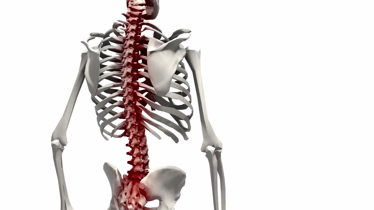 Human 3D Animation Spinal Pain Stock Motion Graphics Motion Array