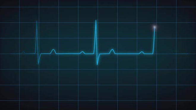 EKG Heart Monitor Flatline - After Effects Templates | Motion Array