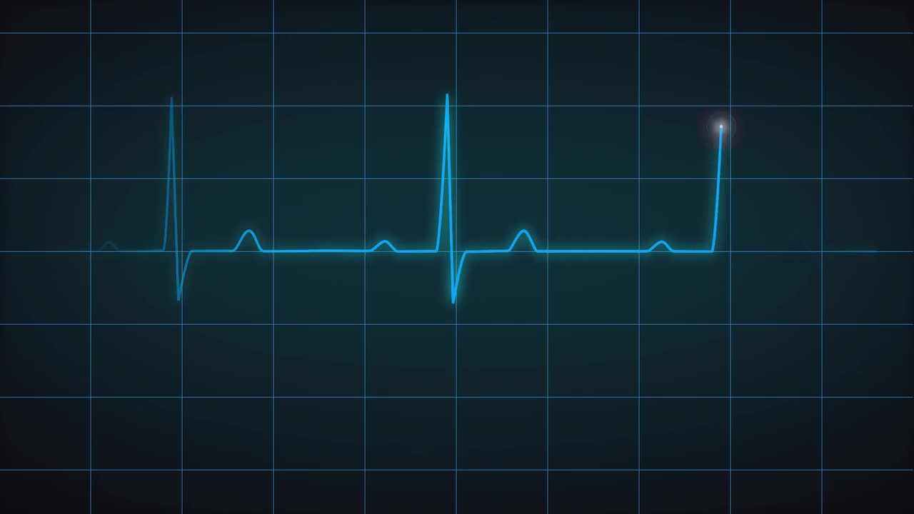 Ekg Heart Monitor Flatline After Effects Templates Motion Array