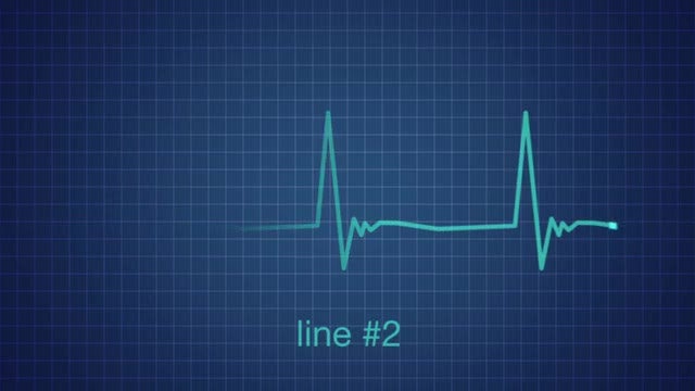 EKG Heart Monitor Flatline: After Effects Templates
