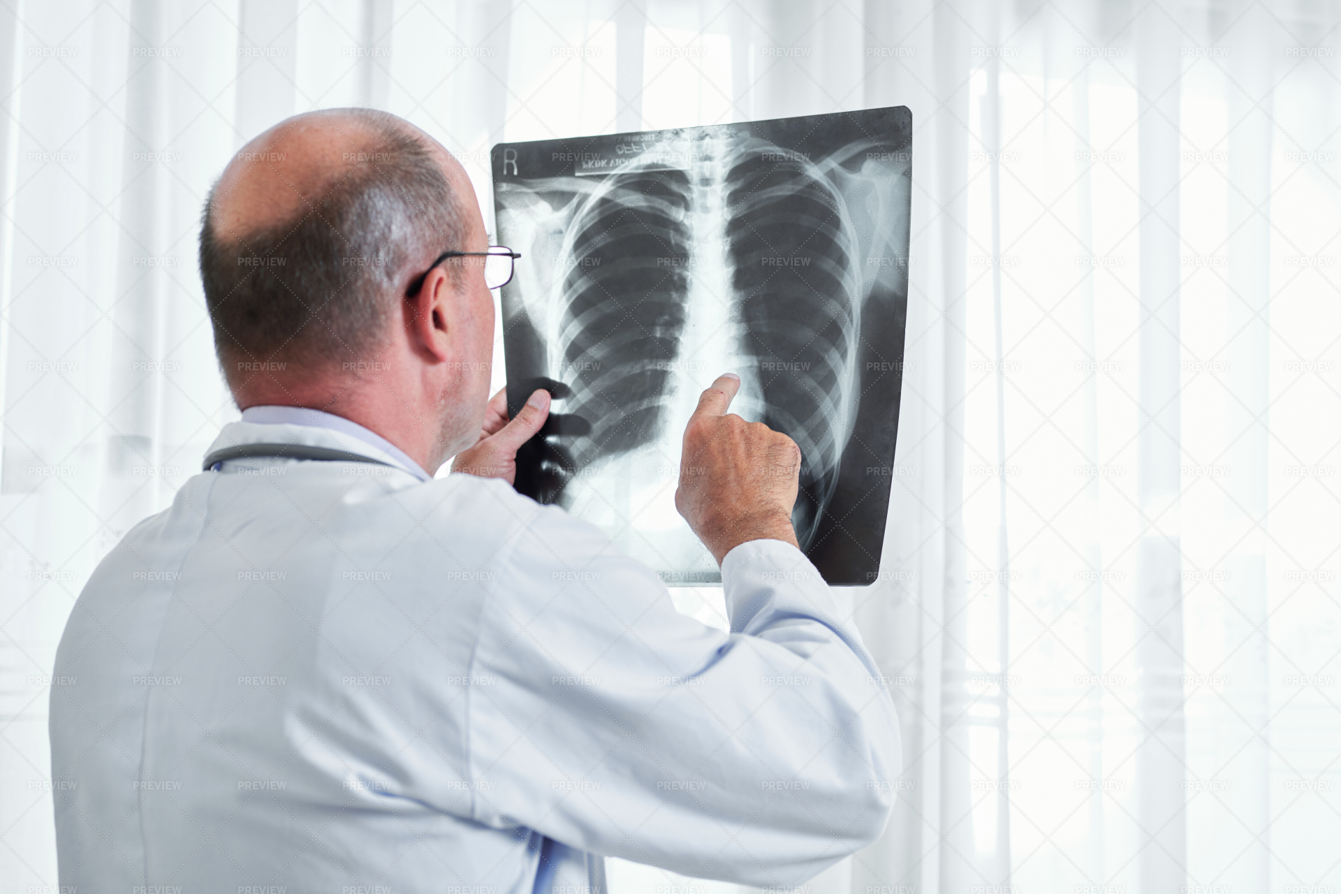 Radiologist Examining Lung X-ray - Stock Photos | Motion Array