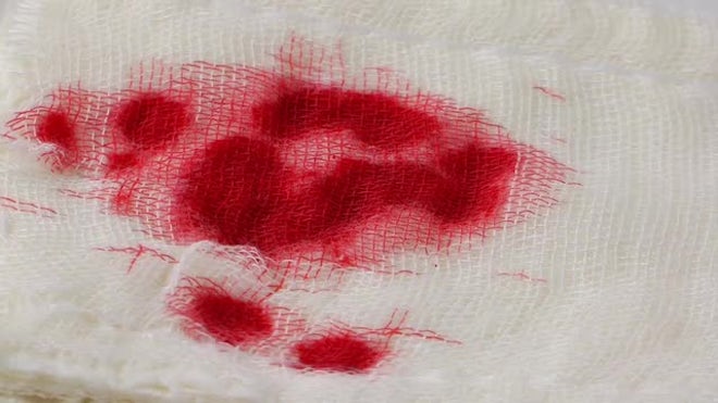 Blood Drops On Gauze Bandage - Stock Video | Motion Array