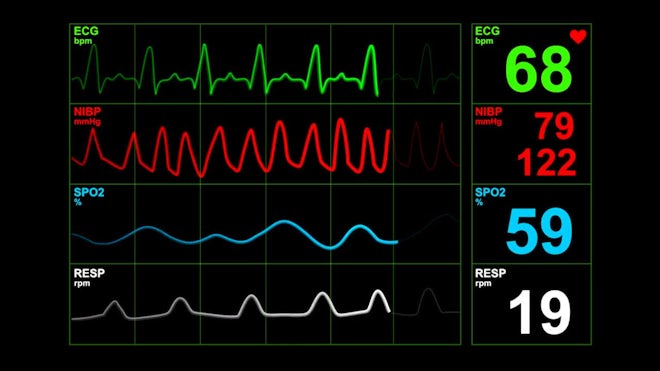 Vitale Signs Screenshot